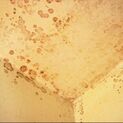 Tan mold spores visibly growing the in upper ceiling corner of a Kirkland home